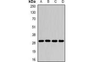 Image no. 2 for anti-Guanidinoacetate N-Methyltransferase (GAMT) antibody (ABIN2966659)