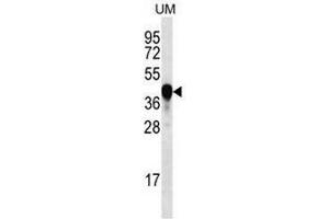 Image no. 2 for anti-Prospero Homeobox 2 (PROX2) (AA 510-540), (C-Term) antibody (ABIN954325)