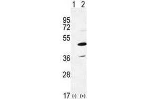 Image no. 3 for anti-Interleukin-1 Receptor-Associated Kinase 4 (IRAK4) (AA 5-36) antibody (ABIN3031498)