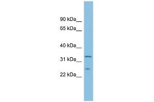 Image no. 1 for anti-Methionine Sulfoxide Reductase A (MSRA) (Middle Region) antibody (ABIN632567)