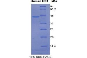 Image no. 4 for Hexokinase 1 (HK1) ELISA Kit (ABIN6574201)