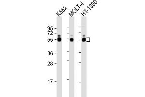 Image no. 3 for anti-Wilms Tumor 1 (WT1) (AA 346-375) antibody (ABIN655904)