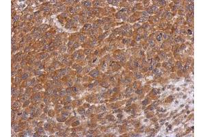 IHC-P Image Immunohistochemical analysis of paraffin-embedded H1299 xenograft, using Dysbindin, antibody at 1:500 dilution.