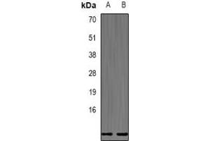 Image no. 1 for anti-Defensin, beta 132 (DEFB132) (full length) antibody (ABIN6004812)