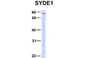 Image no. 4 for anti-Synapse Defective 1, rho GTPase, Homolog 1 (SYDE1) (C-Term) antibody (ABIN2775536)