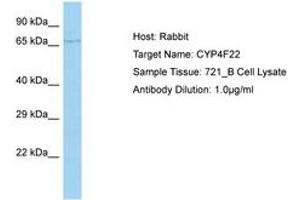 Image no. 1 for anti-Cytochrome P450, Family 4, Subfamily F, Polypeptide 22 (CYP4F22) (AA 207-256) antibody (ABIN6750174)