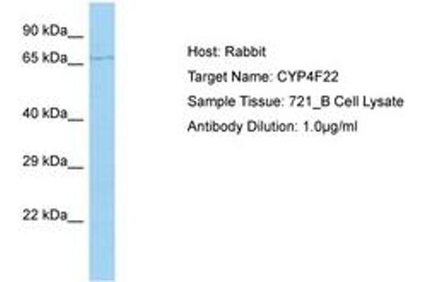 CYP4F22 Antikörper  (AA 207-256)