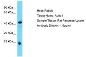 Image no. 1 for anti-Abhydrolase Domain Containing 4 (ABHD4) (AA 80-129) antibody (ABIN6750388)