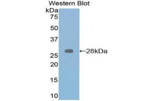 Image no. 1 for anti-Retinoic Acid Receptor, alpha (RARA) (AA 237-459) antibody (ABIN1860407)