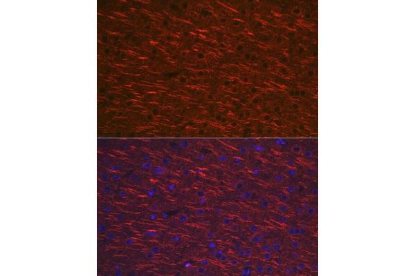 MAP2 antibody  (AA 260-559)
