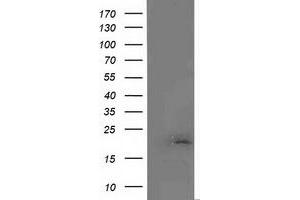 Image no. 1 for anti-Malignant T Cell Amplified Sequence 1 (MCTS1) (AA 1-181) antibody (ABIN2725661)