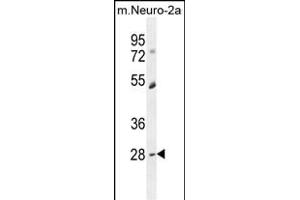 DPCD antibody  (AA 96-136)