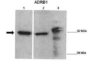 Image no. 5 for anti-Adrenergic, beta-1-, Receptor (ADRB1) (Middle Region) antibody (ABIN2774823)