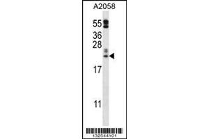 anti-Family with Sequence Similarity 213, Member A (FAM213A) (AA 181-209), (C-Term) antibody