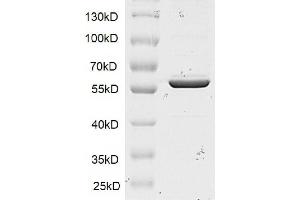 Image no. 1 for SET and MYND Domain Containing 1 (SMYD1) protein (DYKDDDDK Tag) (ABIN2669667)