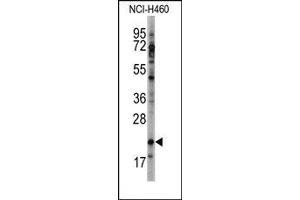 Image no. 1 for anti-Heart and Neural Crest Derivatives Expressed 2 (HAND2) (C-Term) antibody (ABIN358596)
