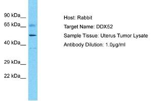 Image no. 1 for anti-DEAD (Asp-Glu-Ala-Asp) Box Polypeptide 52 (DDX52) (C-Term) antibody (ABIN2775209)