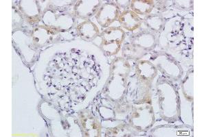 Image no. 1 for anti-RAB20, Member RAS Oncogene Family (RAB20) (AA 131-234) antibody (ABIN2178755)