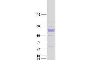 Image no. 1 for Synaptotagmin XIII (SYT13) protein (Myc-DYKDDDDK Tag) (ABIN2733069)