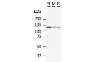 Image no. 1 for anti-Matrin 3 (MATR3) antibody (ABIN328222)