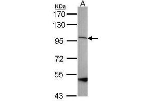 Image no. 1 for anti-Spastic Paraplegia 7 (SPG7) (Internal Region) antibody (ABIN2856975)