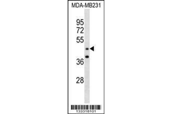 anti-GRAM Domain Containing 3 (GRAMD3) (AA 15-43), (N-Term) antibody