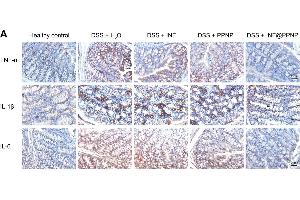 (A) Immunohistochemical staining for TNF-α, IL-1β, and IL-6 in colon tissues of different groups.