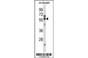 Image no. 1 for anti-Cholinergic Receptor, Nicotinic, alpha 5 (Neuronal) (CHRNA5) (AA 187-216) antibody (ABIN657927)