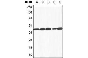 Image no. 2 for anti-Galactokinase 1 (GALK1) (N-Term) antibody (ABIN2707521)