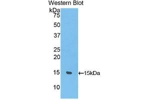 UCP1 Antikörper  (AA 179-296)