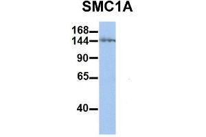 Image no. 3 for anti-Structural Maintenance of Chromosomes 1A (SMC1A) (C-Term) antibody (ABIN2780766)