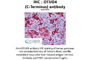 Image no. 1 for anti-OTU Domain Containing 4 (OTUD4) (C-Term) antibody (ABIN1737713)