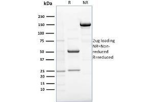 Image no. 1 for anti-Estrogen Receptor Binding Site Associated, Antigen, 9 (EBAG9) antibody (ABIN6941019)