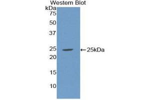 Image no. 1 for anti-Sex Hormone Binding Globulin (SHBG) (AA 224-388) antibody (ABIN1172834)
