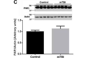anti-Coagulation Factor II (thrombin) Receptor (F2R) (AA 251-350) antibody