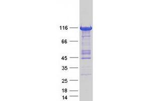 Image no. 1 for phosphorylase Kinase, alpha 1 (Muscle) (PHKA1) (Transcript Variant 2) protein (Myc-DYKDDDDK Tag) (ABIN2728839)