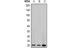 Image no. 2 for anti-Centrin, EF-Hand Protein, 2 (CETN2) antibody (ABIN2966512)