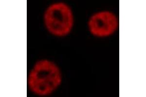 Image no. 5 for anti-Nuclear Factor of kappa Light Polypeptide Gene Enhancer in B-Cells 1 (NFKB1) (pSer923) antibody (ABIN6271194)