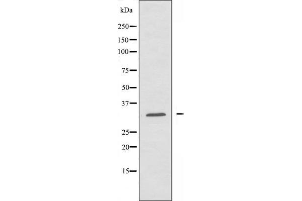 anti-Mitochondrial Ribosomal Protein L46 (MRPL46) (C-Term) antibody