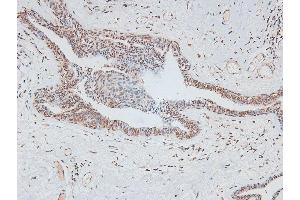 Image no. 3 for anti-V-Myb Myeloblastosis Viral Oncogene Homolog (Avian)-Like 2 (MYBL2) (pThr494), (pThr497) antibody (ABIN6271228)