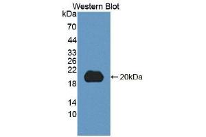 Image no. 1 for anti-5',3'-Nucleotidase, Cytosolic (NT5C) (AA 55-198) antibody (ABIN5013051)