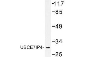 Image no. 1 for anti-Ring Finger Protein 144A (RNF144A) antibody (ABIN317831)