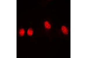 Image no. 2 for anti-Histone Deacetylase 3 (HDAC3) (C-Term), (pSer424) antibody (KLH) (ABIN2972575)