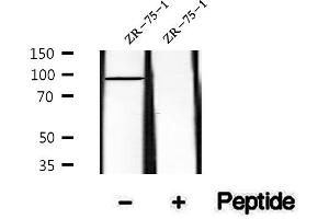 Image no. 1 for anti-Slingshot Homolog 3 (SSH3) (pSer37) antibody (ABIN6255269)