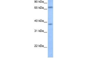 Image no. 1 for anti-Fem-1 Homolog B (FEM1B) (Middle Region) antibody (ABIN2785526)