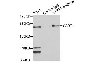 Image no. 2 for anti-Squamous Cell Carcinoma Antigen Recognized By T Cells (SART1) antibody (ABIN6571846)