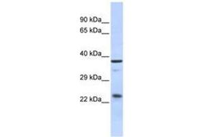 Image no. 1 for anti-SERTA Domain Containing 1 (SERTAD1) (AA 35-84) antibody (ABIN6742458)