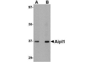 Image no. 2 for anti-Aryl Hydrocarbon Receptor Interacting Protein-Like 1 (AIPL1) (C-Term) antibody (ABIN499249)
