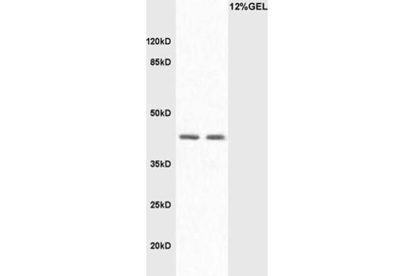 LAMP2 抗体  (AA 301-411)