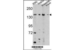 Image no. 1 for anti-5-Oxoprolinase (ATP-Hydrolysing) (OPLAH) (AA 1-30), (N-Term) antibody (ABIN391687)